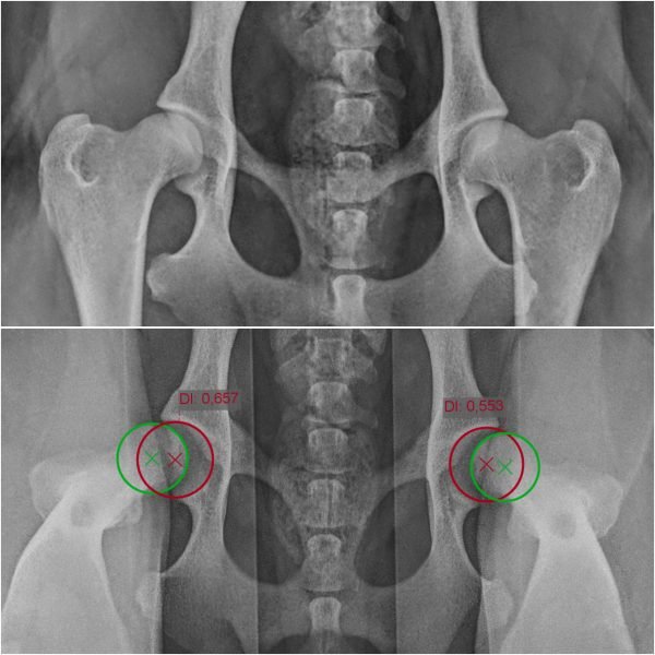 Hip joint distractor - Image 3